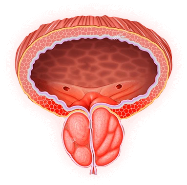 Hombre aliviado de problemas de próstata con Prostalis