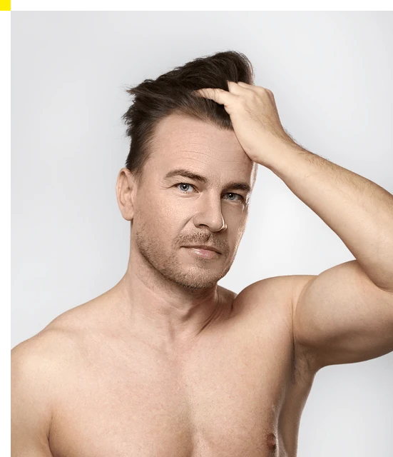 Hombre con cabello denso y fuerte tras usar Folicerin.