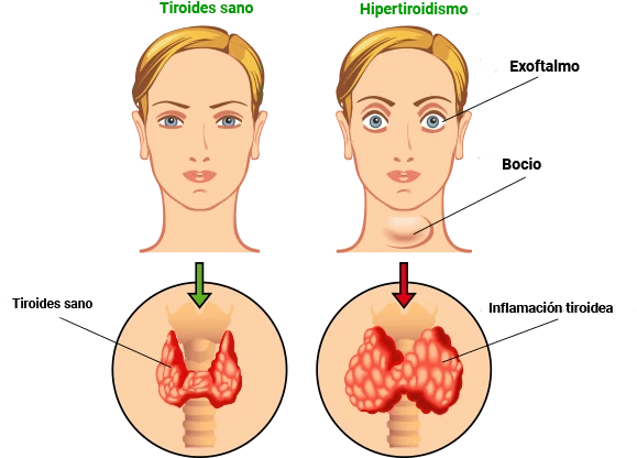 Anatomía y salud de la glándula tiroides